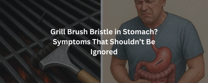 Grill Brush Bristle in Stomach? Symptoms That Shouldn’t Be Ignored